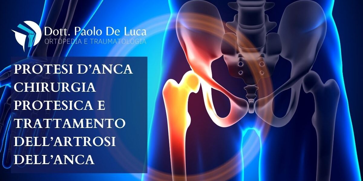 Protesi Anca Teramo | Chirurgia Protesica | Dott. Paolo De Luca