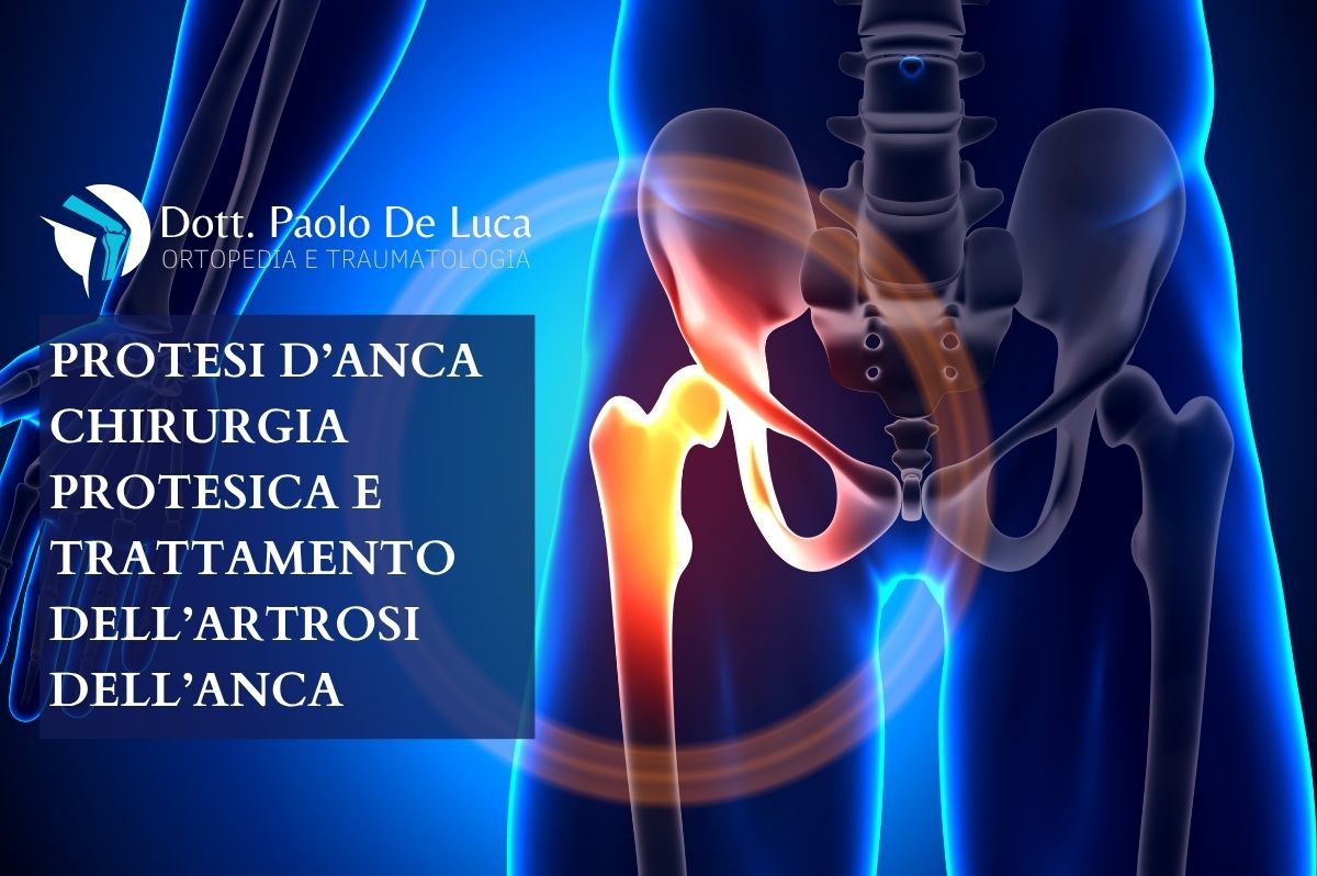 Protesi Anca Teramo | Chirurgia Protesica | Dott. Paolo De Luca